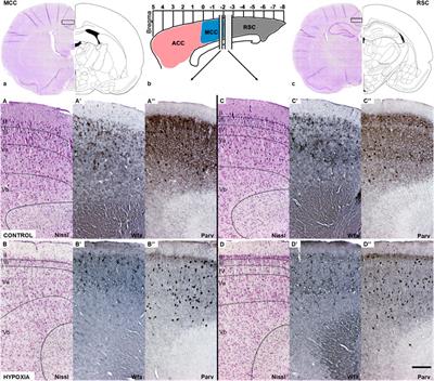 The Signature of Moderate Perinatal Hypoxia on Cortical Organization and Behavior: Altered PNN-Parvalbumin Interneuron Connectivity of the Cingulate Circuitries